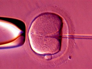 What to Consider before doing IVF?